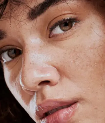 MAESKN Aesthetics - Melasma