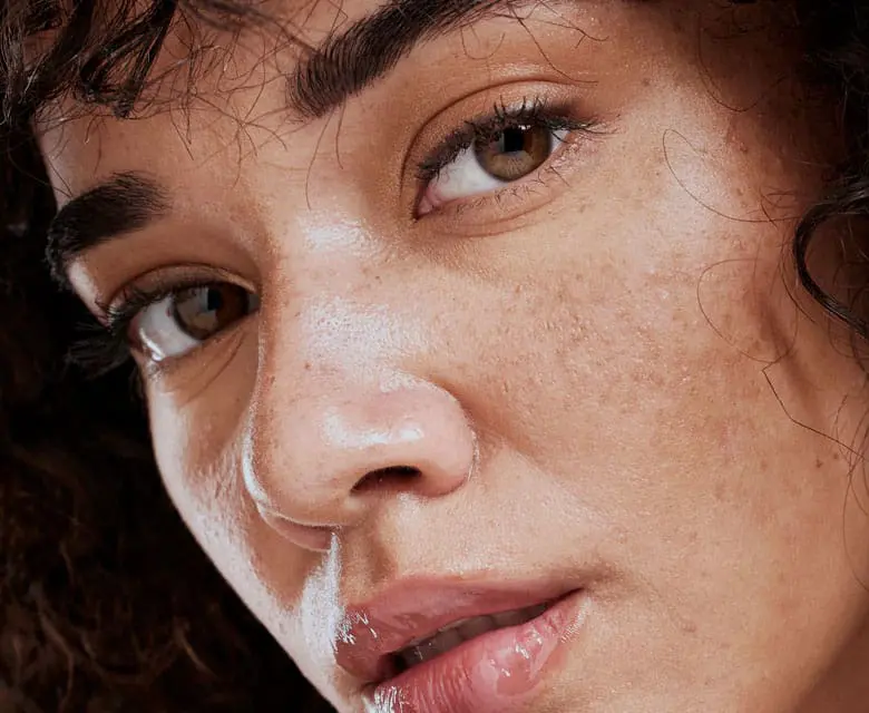 MAESKN Aesthetics - Melasma