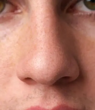 MAESKN Aesthetics - Open & Enlarge Pores