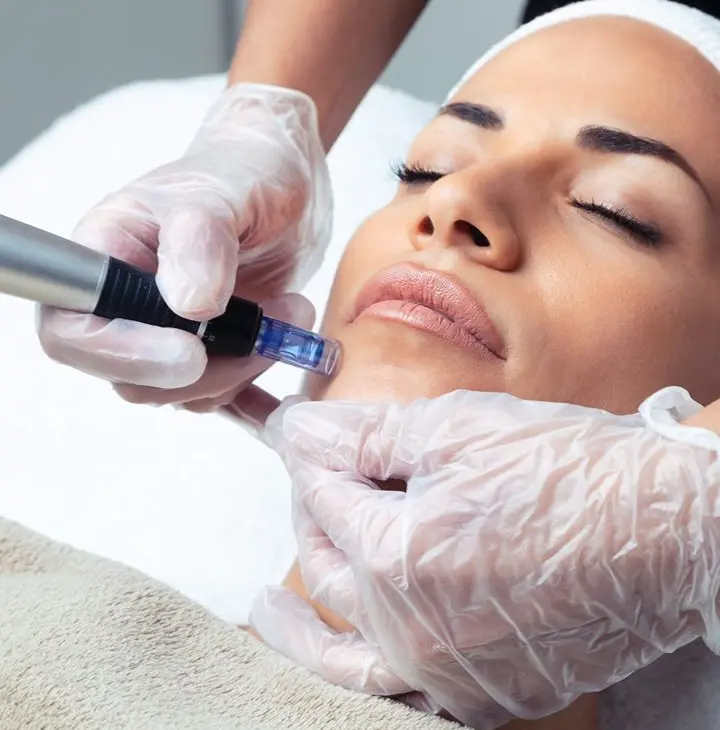 Microneedling & Exosomes