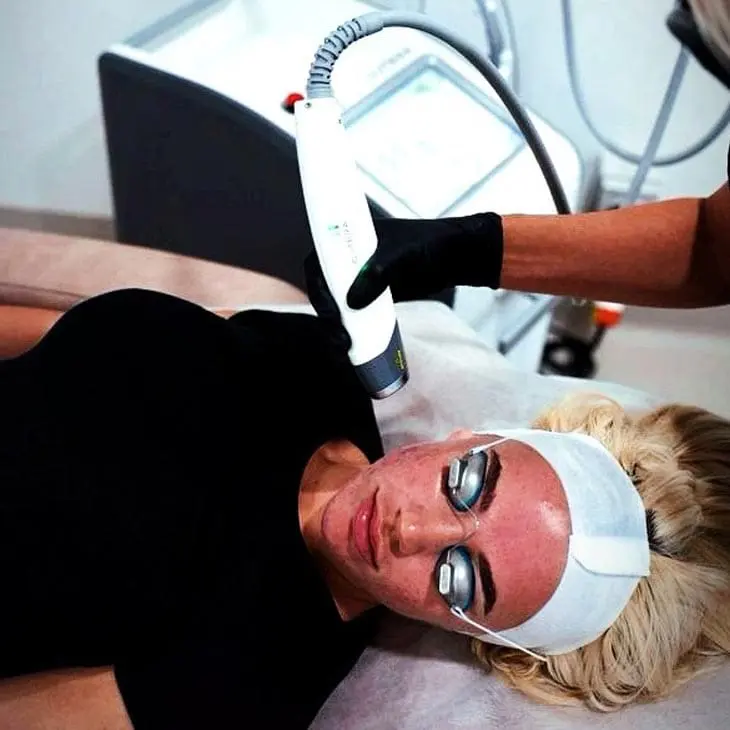 MAESKN Aesthetics - Acne & Acne Rosacea Reduction 2