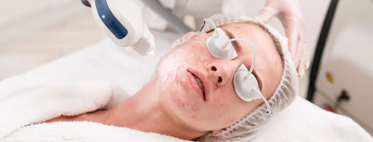 MAESKN Aesthetics - Acne & Acne rosacea reduction