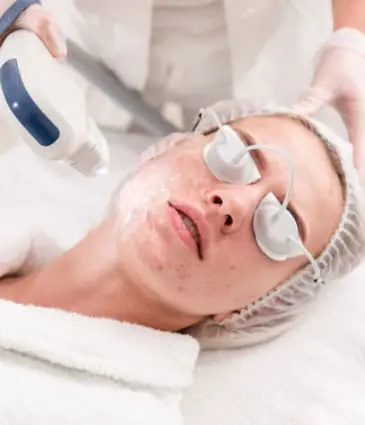 MAESKN Aesthetics - Acne & Acne rosacea reduction