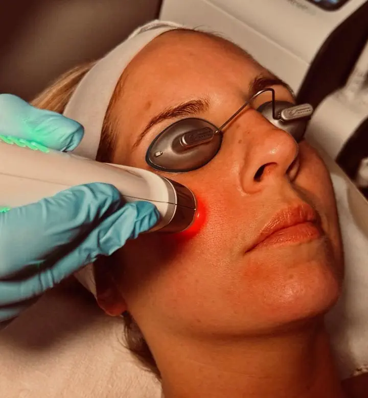 MAESKN Aesthetics - Rosacea & Redness Reduction
