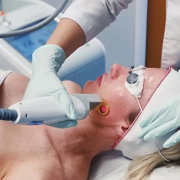 MAESKN Aesthetics - Rosacea & Redness reduction 2