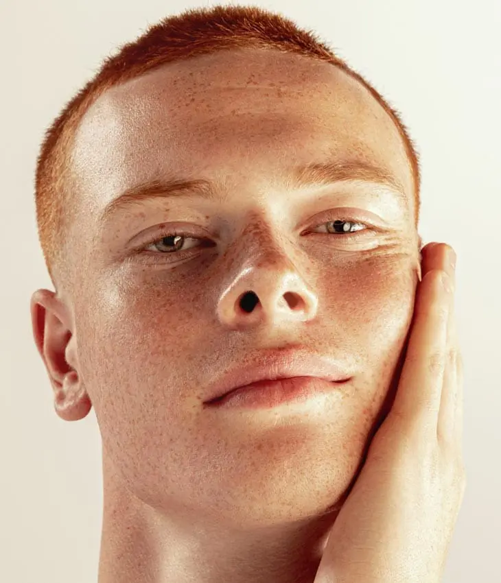 MAESKN Aesthetics - Superficial Acne Scar Refinement 2