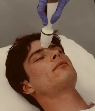 MAESKN Aesthetics - Superficial Acne Scar Refinement