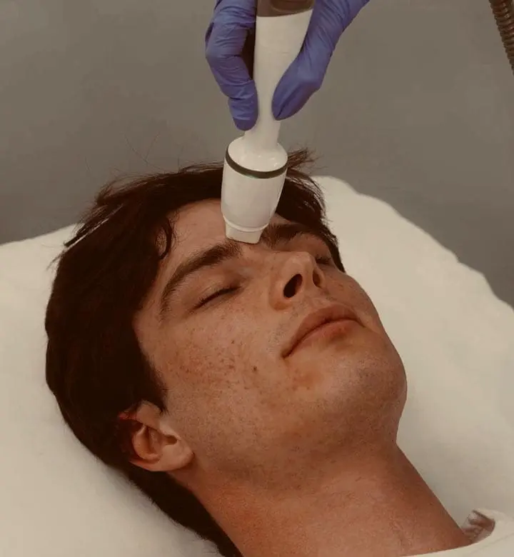 MAESKN Aesthetics - Superficial Acne Scar Refinement