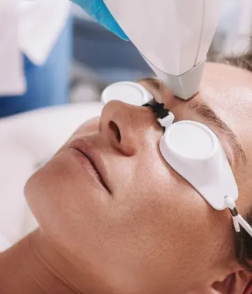 laser hair removal - feature image for google search