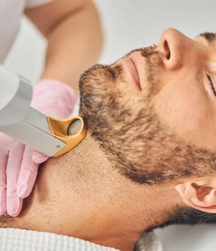 mens laser hair removal on neck and face - laser hair removal content image 2