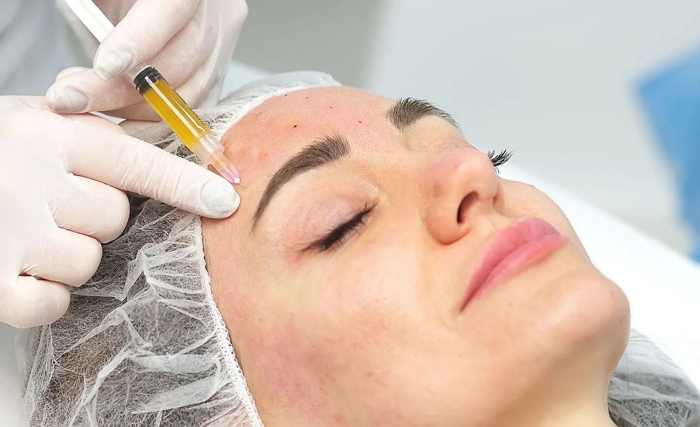 skin booster injections