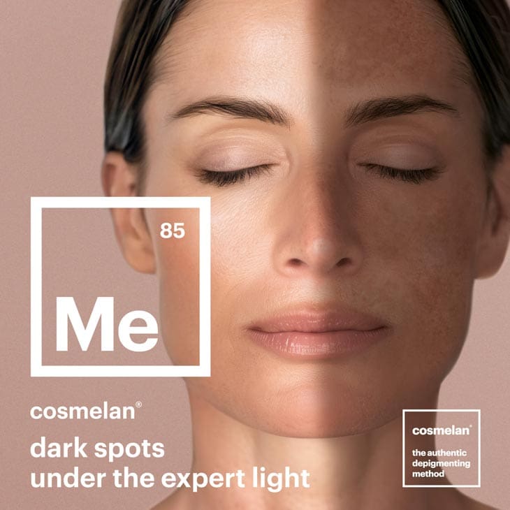 MAESKN Aesthetics - Melasma 3