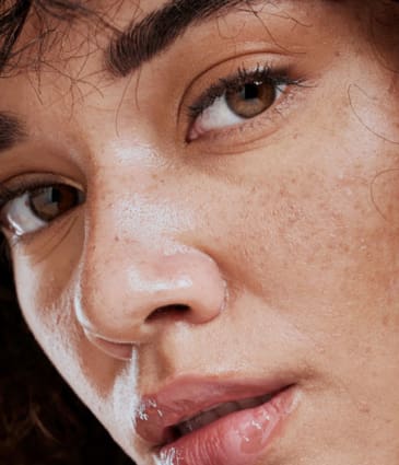 MAESKN Aesthetics - Melasma