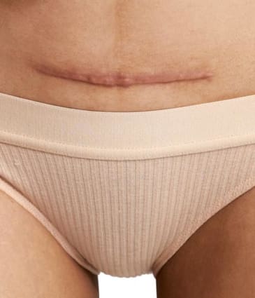 MAESKN Aesthetics - Scarring - post surgical