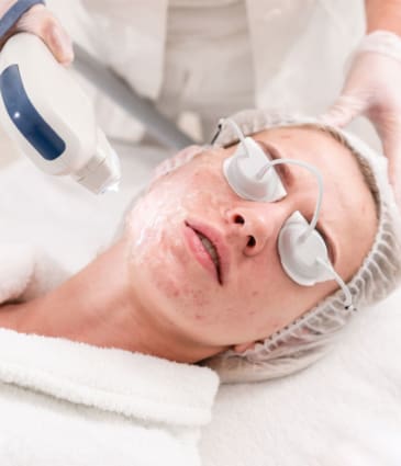 MAESKN Aesthetics - Acne & Acne rosacea reduction