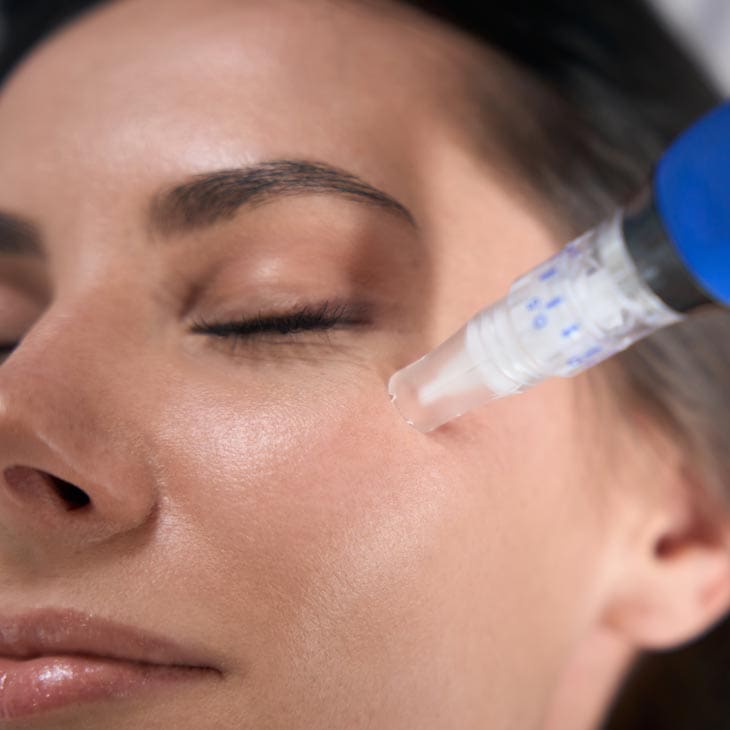 MAESKN Aesthetics - Microneedling & Exosomes 1