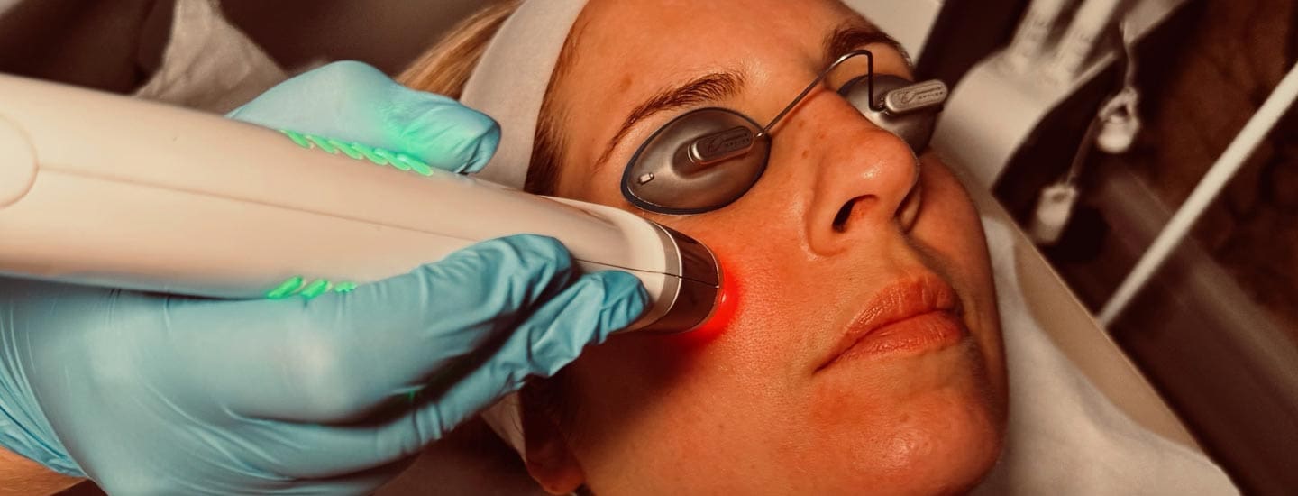 MAESKN Aesthetics - Rosacea & Redness Reduction