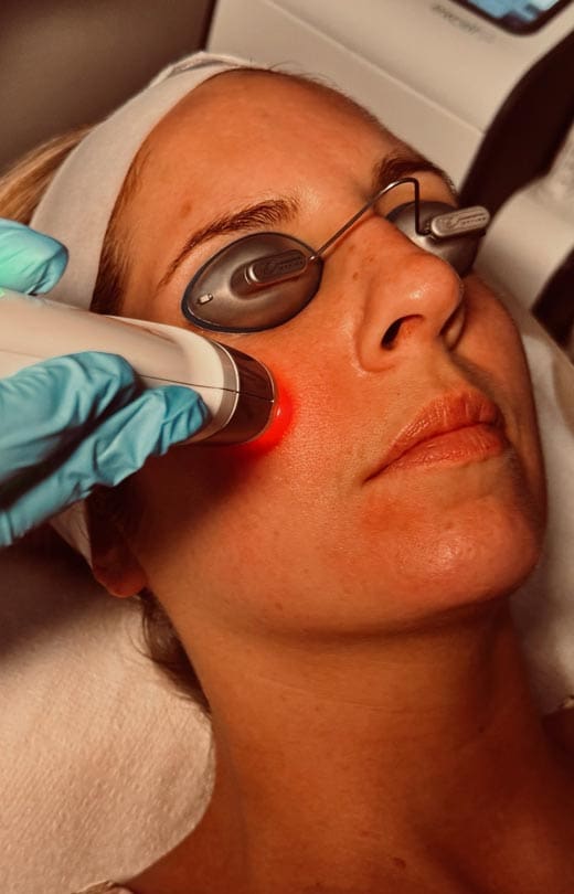 MAESKN Aesthetics - Rosacea & Redness Reduction