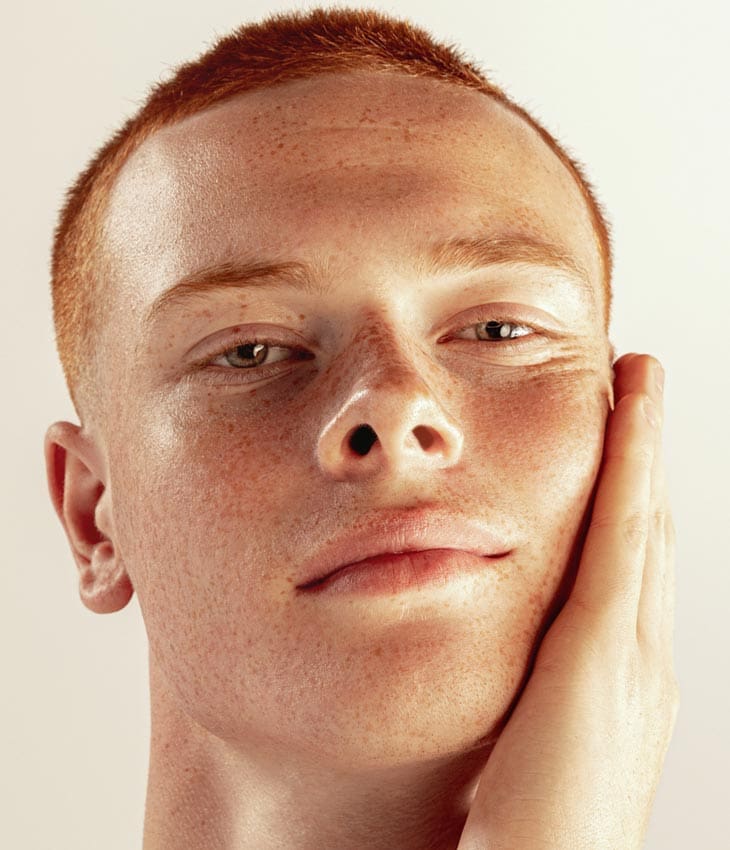 MAESKN Aesthetics - Superficial Acne Scar Refinement 2