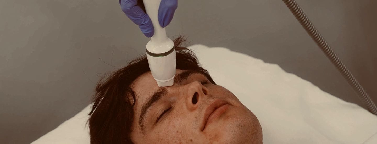 MAESKN Aesthetics - Superficial Acne Scar Refinement