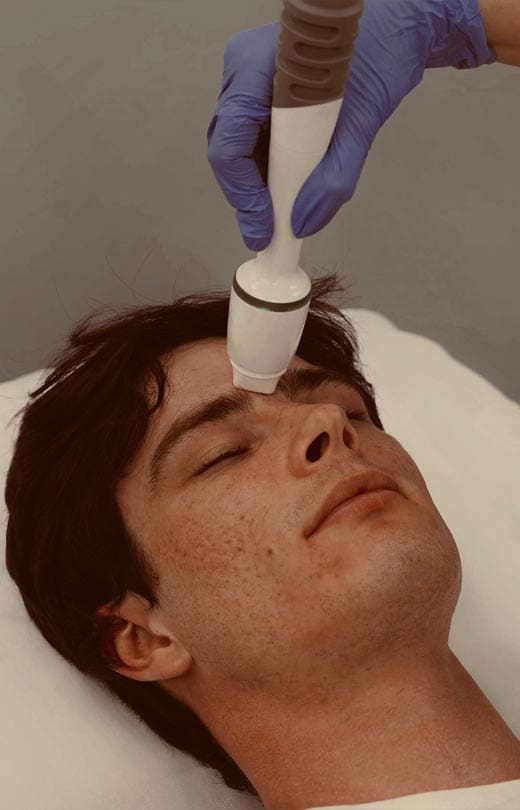 MAESKN Aesthetics - Superficial Acne Scar Refinement