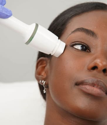 MAESKN - state of the art laser technology-